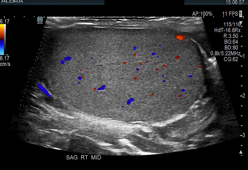 Testis ColorTrapezoid 10